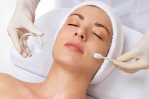 Chemical Peel