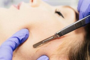 Dermaplaning